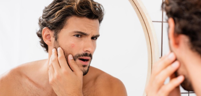 Uomo che osserva l'acne allo specchio - Peeling maschile